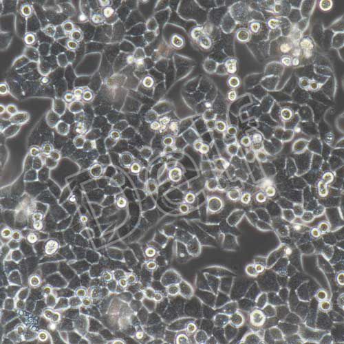 HELA+luc 人宮頸癌細胞HELA熒光素酶標(biāo)記