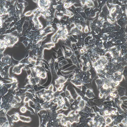 LOVO+luc 人結直腸癌細胞熒光素酶標記