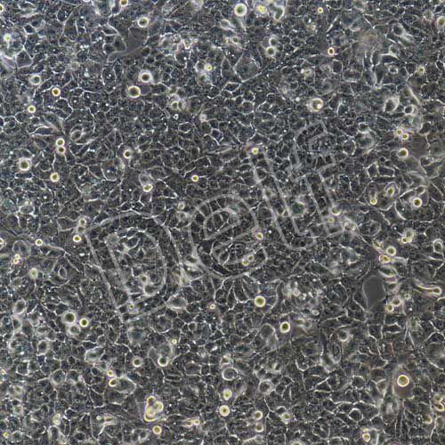 MHCC-97H+luc 人高轉移潛能肝癌細胞熒光素酶標記