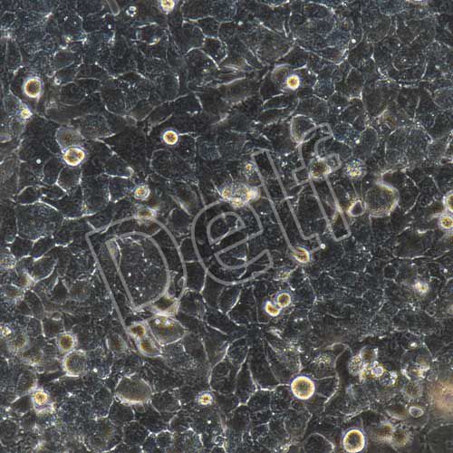 MHCC-97H+luc 人高轉移潛能肝癌細胞熒光素酶標記