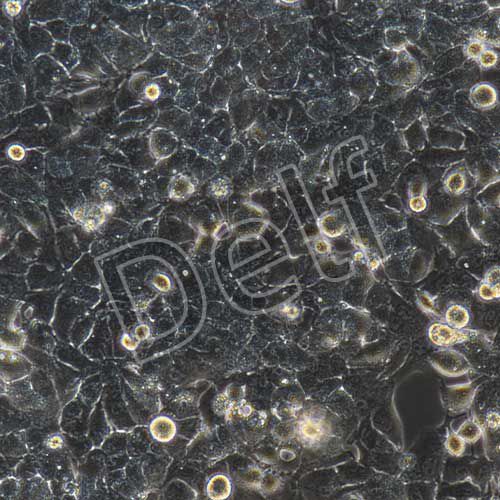 MHCC-97H+luc 人高轉移潛能肝癌細胞熒光素酶標記