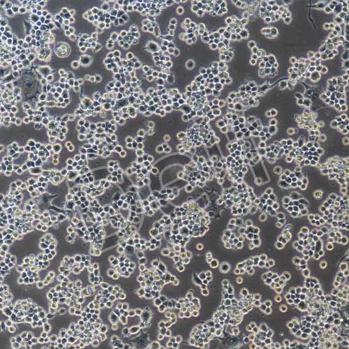 Neuro-2a+luc 小鼠腦神經(jīng)瘤細(xì)胞熒光素酶標(biāo)記