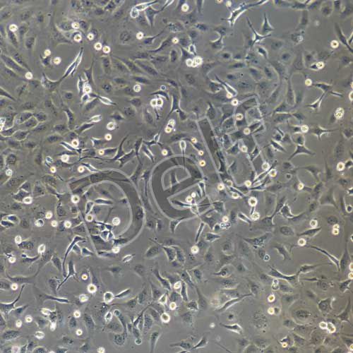 SK-OV-3+luc 人卵巢癌細胞熒光素酶標記