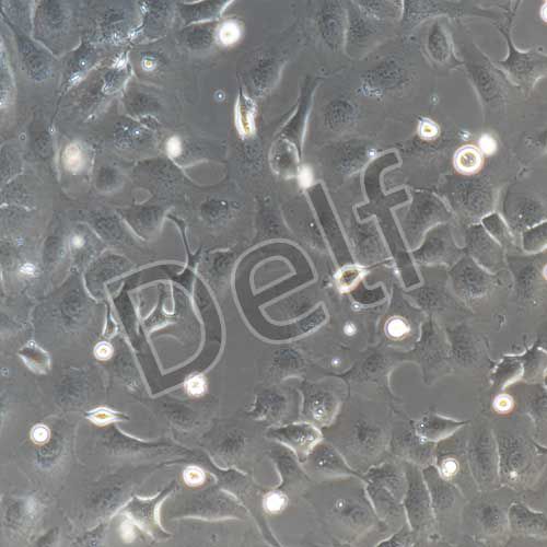 SK-OV-3+luc 人卵巢癌細胞熒光素酶標記