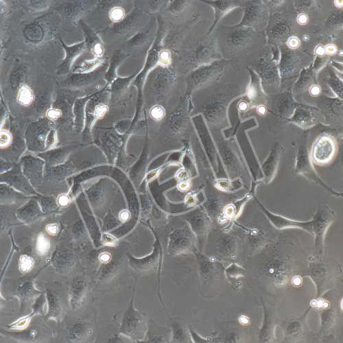 SK-OV-3+luc 人卵巢癌細胞熒光素酶標記