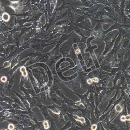 U251MG/TMZ+luc 人類星形膠質(zhì)瘤耐替莫唑胺細(xì)胞