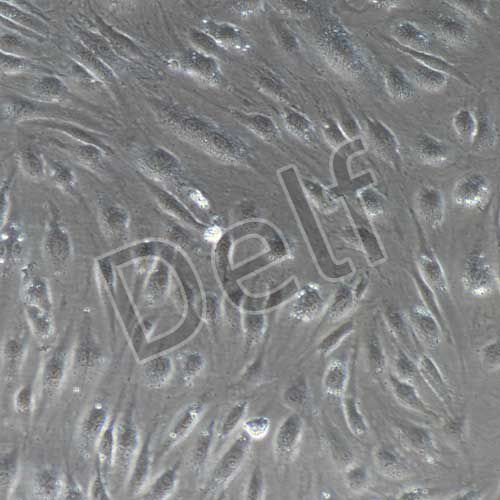 HUVEC+RFP 人臍靜脈內(nèi)皮細(xì)胞永生化+RFP