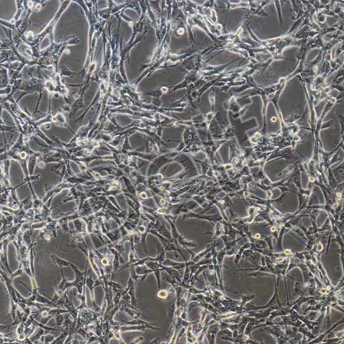 U87MG+RFP 人腦星形膠質(zhì)母細(xì)胞瘤+RFP