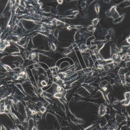 U87MG+RFP 人腦星形膠質(zhì)母細(xì)胞瘤+RFP