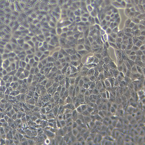 ARPE-19 人視網(wǎng)膜色素上皮細胞