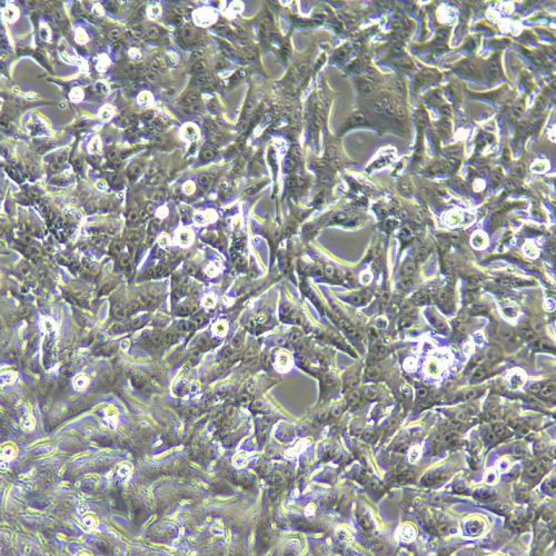 HEPA1-6 小鼠肝癌細(xì)胞