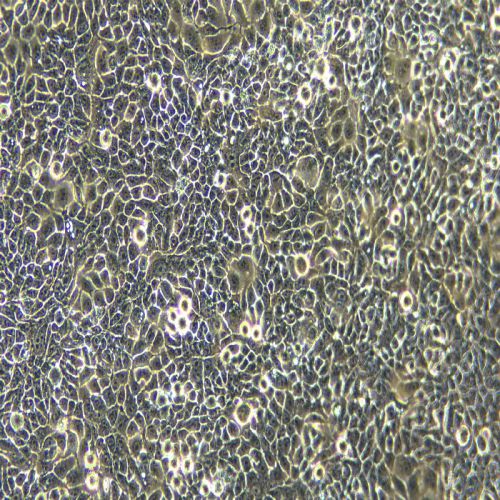 CAL33人舌磷癌細胞