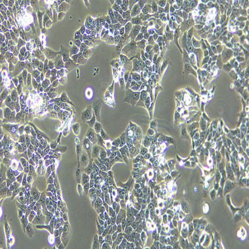 CAL33人舌磷癌細胞