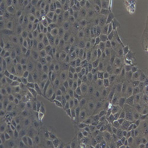 HuH-6 人肝母細胞瘤細胞