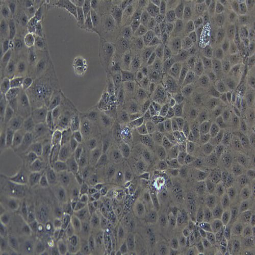 HuH-6 人肝母細胞瘤細胞