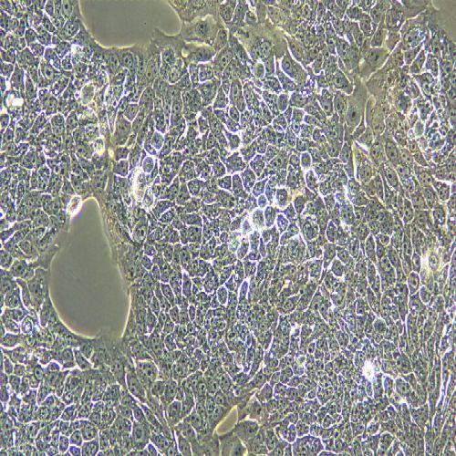 KYSE-510 人食管鱗狀細(xì)胞癌細(xì)胞
