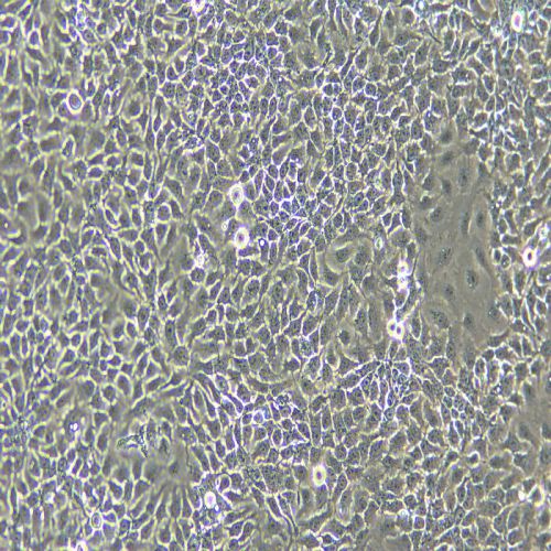 NCI-H292 人肺癌細(xì)胞(淋巴結(jié)轉(zhuǎn)移)