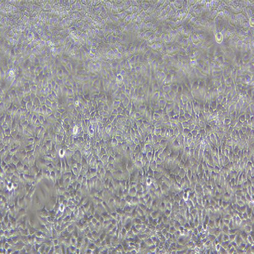 NCI-H292 人肺癌細(xì)胞(淋巴結(jié)轉(zhuǎn)移)