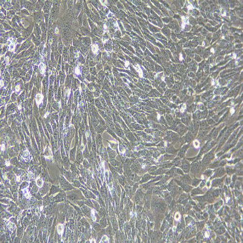 MOVAS 小鼠主動脈血管平滑肌細胞