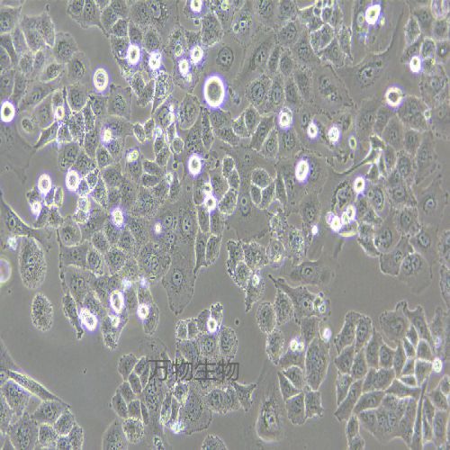 MFE-296人子宮內(nèi)膜癌細(xì)胞