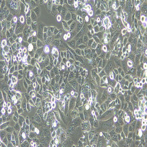 MFE-296人子宮內(nèi)膜癌細(xì)胞