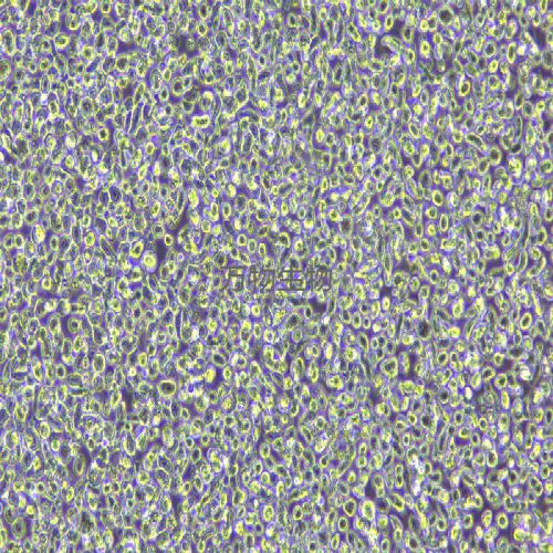 LP-1人多發(fā)性骨髓瘤細(xì)胞