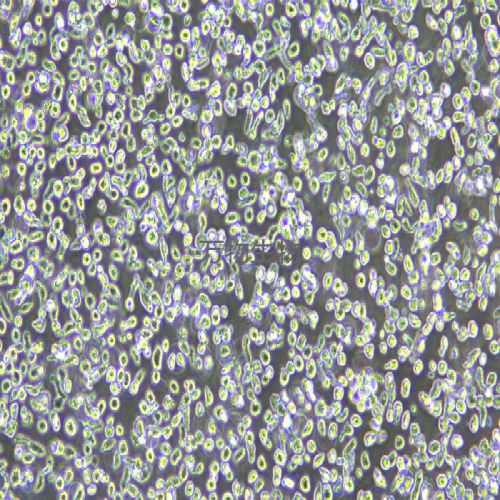 LP-1人多發(fā)性骨髓瘤細(xì)胞