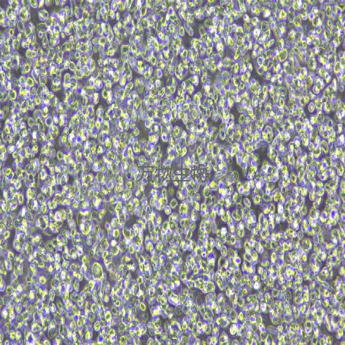 LP-1人多發(fā)性骨髓瘤細(xì)胞