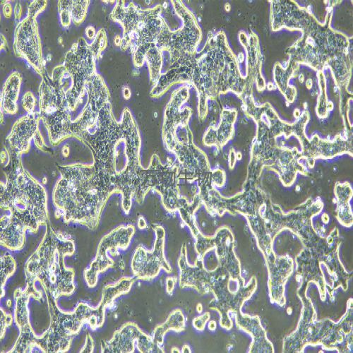 SNU719人胃癌細胞