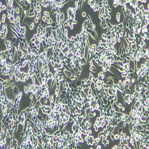 LLC 小鼠Lewis肺癌細胞