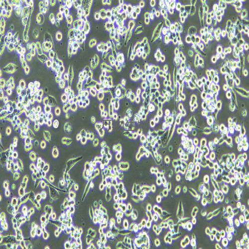 LLC 小鼠Lewis肺癌細胞