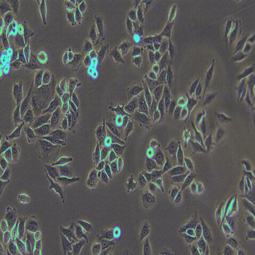 SiHa 人子宮頸鱗癌細(xì)胞