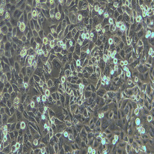 SW872人脂肪肉瘤細(xì)胞