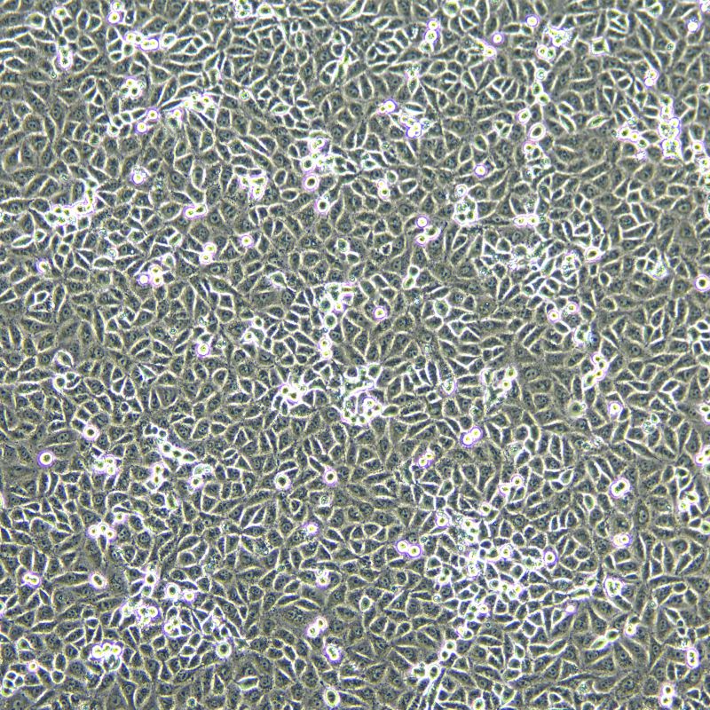 A549/DDP 人肺癌細(xì)胞(A549順鉑耐藥株)