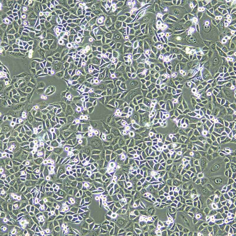 PC-9 人肺癌細(xì)胞奧西替尼耐藥株