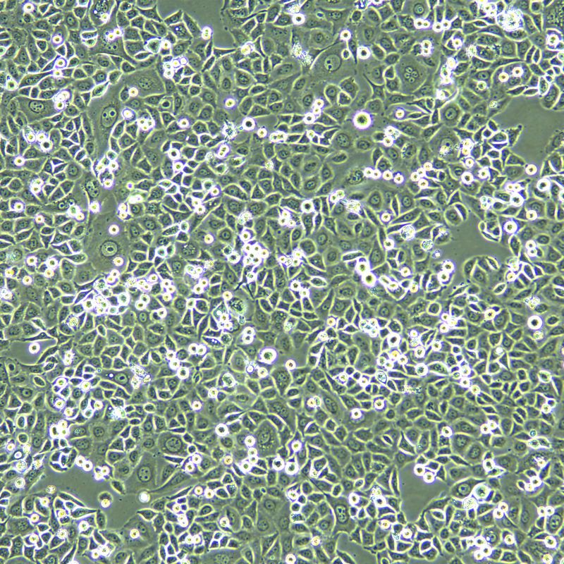 PC-9 人肺癌細(xì)胞奧西替尼耐藥株