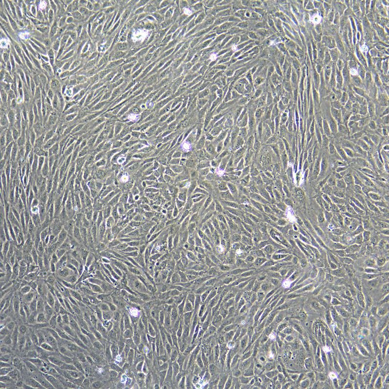 人原代臍靜脈內(nèi)皮細(xì)胞