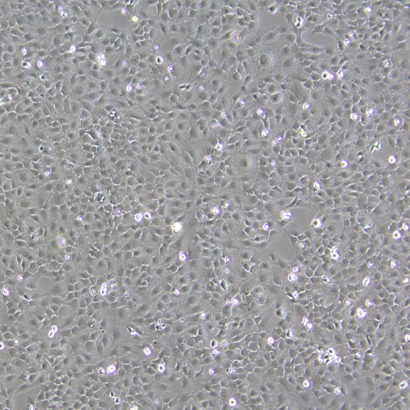 HMEC-1 人微血管內(nèi)皮細胞株