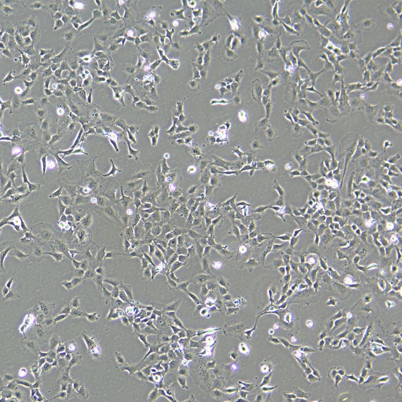 HMEC-1 人微血管內(nèi)皮細胞株