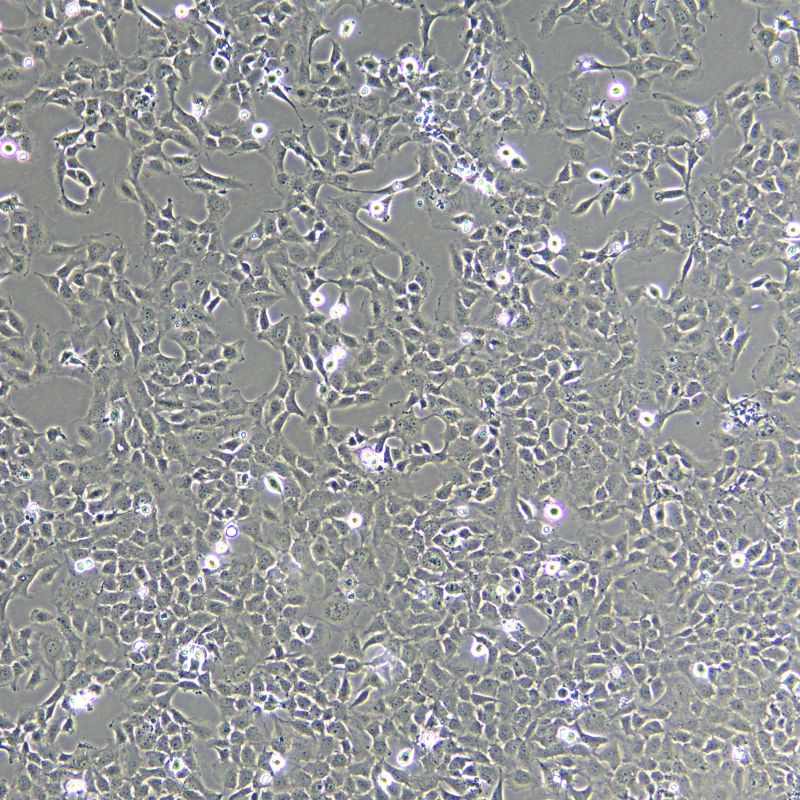 HMEC-1 人微血管內(nèi)皮細胞株