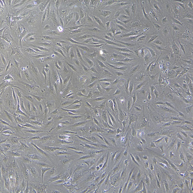 人原代冠狀動脈內(nèi)皮細胞