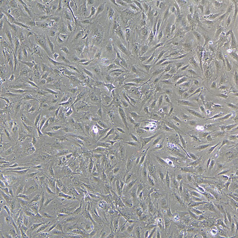 人原代冠狀動脈內(nèi)皮細胞