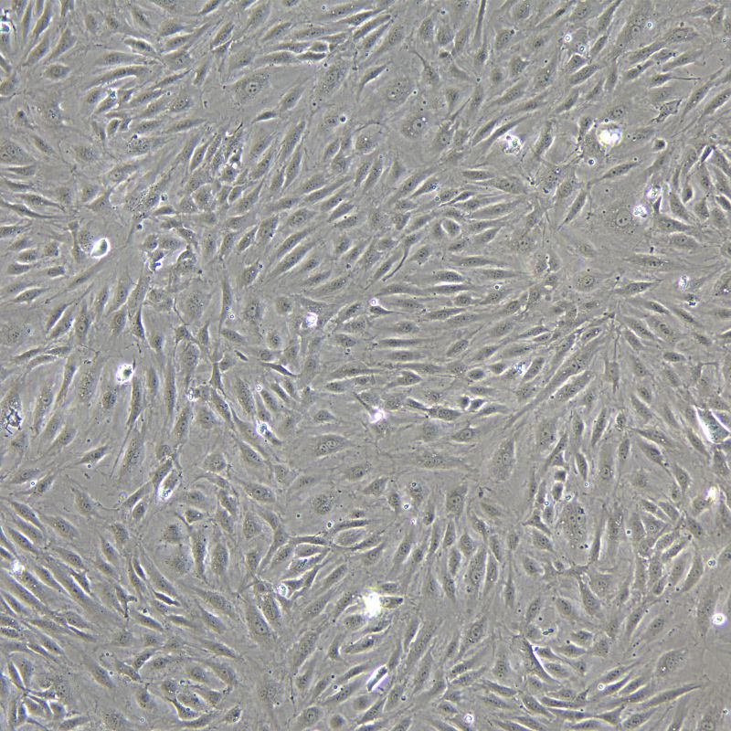 人原代冠狀動脈內(nèi)皮細胞